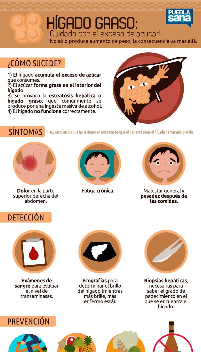Hígado graso: Síntomas, tipos y prevención. Hígado graso: Síntomas, tipos y prevención.