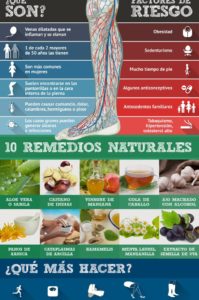 infografía varices