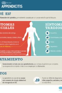 infografía apendicitis