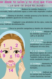 infografía acné