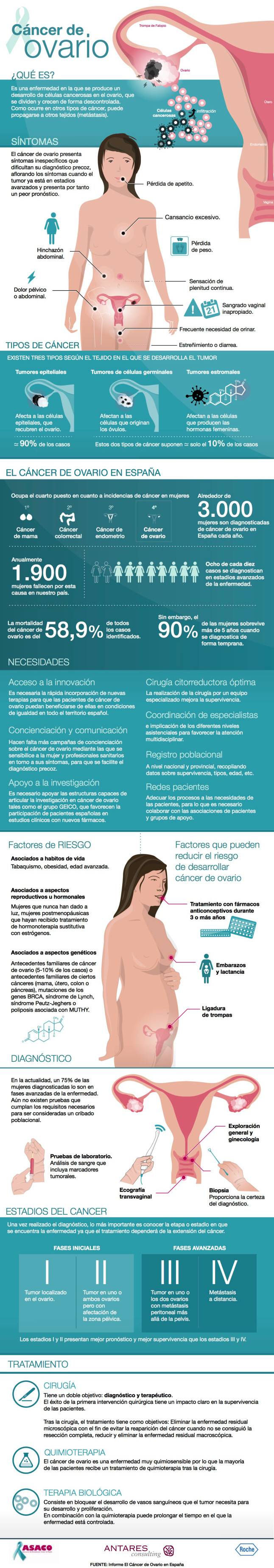 infografía cáncer de ovarios