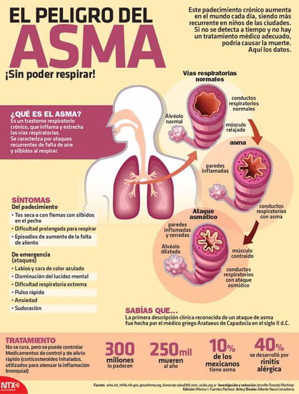 qué es el asma y sus síntomas