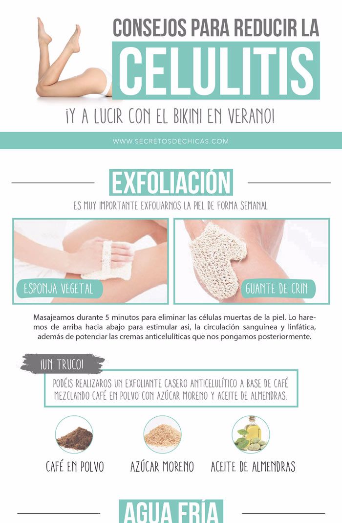 Consejos para reducir la celulitis en las piernas Infografías y Remedios Consejos para reducir la celulitis en las piernas Infografías y Remedios